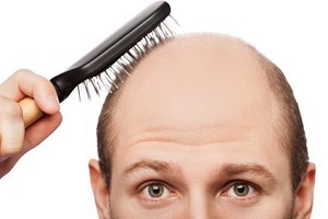 Hair loss