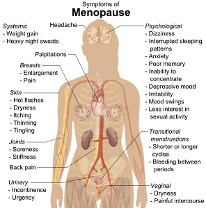 Menopause