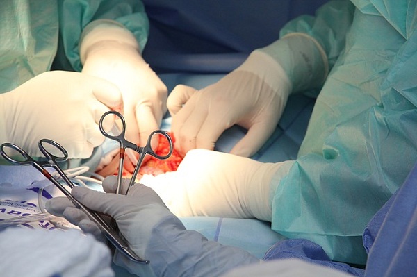 surgical procedure